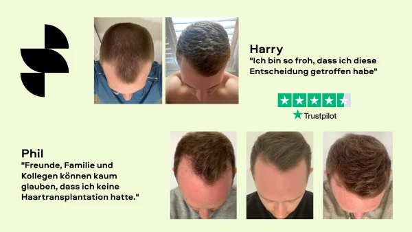 Haarausfall Behandlungen Bewertungen von Kunden
